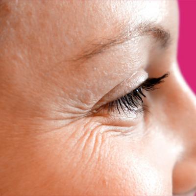 5 Tricks to Get Rid of Under Eye Wrinkles