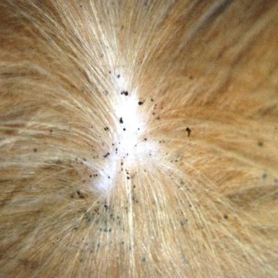 How To Get Rid of Fleas on Humans Naturally
