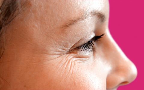 5 Tricks to Get Rid of Under Eye Wrinkles
